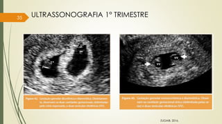 35
ZUGAIB, 2016.
ULTRASSONOGRAFIA 1° TRIMESTRE
 