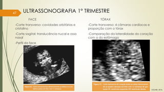 FACE
-Corte transverso: cavidades orbitárias e
cristalino
-Corte sagital: translucência nucal e osso
nasal
-Perfil da face
TÓRAX
-Corte transverso: 4 câmaras cardíacas e
proporção com o tórax
-Comparação da lateralidade do coração
com a do estômago
47 ULTRASSONOGRAFIA 1° TRIMESTRE
ZUGAIB, 2016.
 