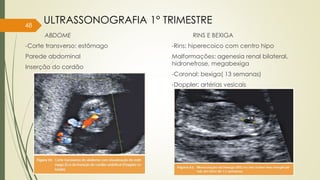 ABDOME
-Corte transverso: estômago
Parede abdominal
Inserção do cordão
RINS E BEXIGA
-Rins: hiperecoico com centro hipo
Malformações: agenesia renal bilateral,
hidronefrose, megabexiga
-Coronal: bexiga( 13 semanas)
-Doppler: artérias vesicais
48
ULTRASSONOGRAFIA 1° TRIMESTRE
 