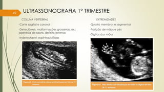 COLUNA VERTEBRAL
-Corte sagital e coronal
-Detectáveis: malformações grosseiras, ex.:
agenesia de sacro, defeito extenso
-Indetectável: espinhas bífidas
EXTREMIDADES
-Quatro membros e segmentos
-Posição de mãos e pés
-Dígitos das mãos
49 ULTRASSONOGRAFIA 1° TRIMESTRE
 