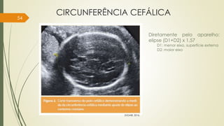CIRCUNFERÊNCIA CEFÁLICA
54
ZUGAIB, 2016.
Diretamente pelo aparelho:
elipse (D1+D2) x 1,57
D1: menor eixo, superfície externa
D2: maior eixo
 