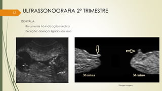 GENITÁLIA
Raramente há indicação médica
Exceção: doenças ligadas ao sexo
Google Imagens
57 ULTRASSONOGRAFIA 2° TRIMESTRE
 