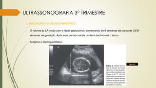63
2. AVALIAÇÃO DO LÍQUIDO AMNIÓTICO
• O volume do LA muda com a idade gestacional, aumentando de 8 semanas até cerca de 33/34
semanas de gestação. Após este período existe um leve declínio até o termo.
• Subjetivo x Semiquantitativo
Figura 41
ULTRASSONOGRAFIA 3° TRIMESTRE
 