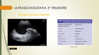 65
AVALIAÇÃO DO LÍQUIDO AMNIÓTICO
ULTRASSONOGRAFIA 3° TRIMESTRE
Figura 42
ZUGAIB, 2016.
 