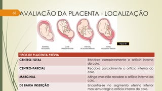 AVALIAÇÃO DA PLACENTA - LOCALIZAÇÃO
TIPOS DE PLACENTA PRÉVIA
CENTRO-TOTAL Recobre completamente o orifício interno
do colo.
CENTRO-PARCIAL Recobre parcialmente o orifício interno do
colo.
MARGINAL Atinge mas não recobre o orifício interno do
colo.
DE BAIXA INSERÇÃO Encontra-se no segmento uterino inferior
mas sem atingir o orifício interno do colo.
68
Figura 45
 