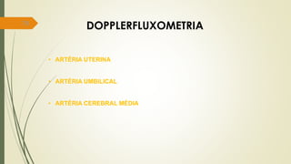 79
DOPPLERFLUXOMETRIA
• ARTÉRIA UTERINA
• ARTÉRIA UMBILICAL
• ARTÉRIA CEREBRAL MÉDIA
 