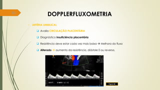 81
DOPPLERFLUXOMETRIA
• ARTÉRIA UMBILICAL
 Avalia CIRCULAÇÃO PLACENTÁRIA
 Diagnóstico insuficiência placentária
 Resistência deve estar cada vez mais baixa  Melhora do fluxo
 Alterado  aumento da resistência, diástole 0 ou reversa.
Figura 50
 