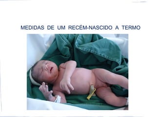 MEDIDAS DE UM RECÉM-NASCIDO A TERMO
 