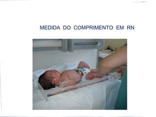 MEDIDA DO COMPRIMENTO EM RN
 