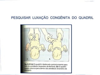 PESQUISAR LUXAÇÃO CONGÊNITA DO QUADRIL
 