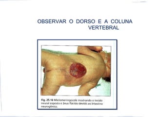 OBSERVAR O DORSO E A COLUNA
VERTEBRAL
 