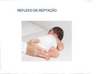 REFLEXO DE REPTAÇÃO
 