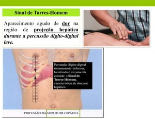 Sinal de Torres-Homem
Aparecimento agudo de dor na
região de projeção hepática
durante a percussão dígito-digital
leve.
 