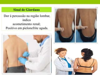 Sinal de Giordano
Dor à percussão na região lombar,
indica
acometimento renal;
Positivo em pielonefrite aguda.
 