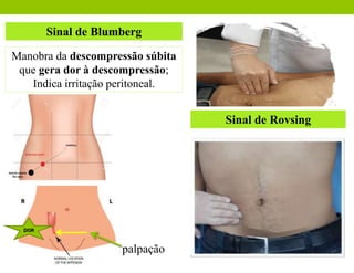 Sinal de Blumberg
Manobra da descompressão súbita
que gera dor à descompressão;
Indica irritação peritoneal.
Sinal de Rovsing
DOR
palpação
 