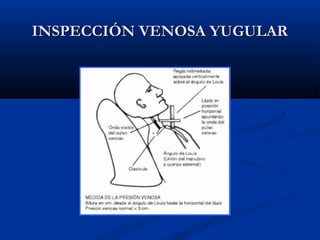 INSPECCIÓN VENOSA YUGULARINSPECCIÓN VENOSA YUGULAR
 