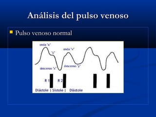Análisis del pulso venosoAnálisis del pulso venoso
 Pulso venoso normalPulso venoso normal
 