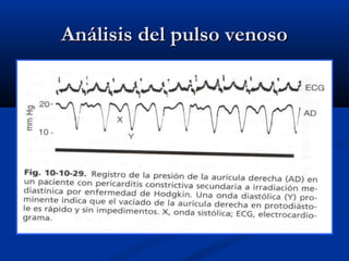 Análisis del pulso venosoAnálisis del pulso venoso
 