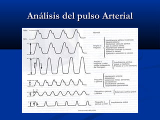 Análisis del pulso ArterialAnálisis del pulso Arterial
 