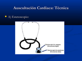 Auscultación Cardiaca: TécnicaAuscultación Cardiaca: Técnica
 A) Estetoscopio:A) Estetoscopio:
 