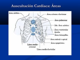 Auscultación Cardiaca: ÁreasAuscultación Cardiaca: Áreas
 