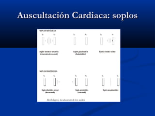Auscultación Cardiaca: soplosAuscultación Cardiaca: soplos
 