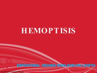 HEMOPTISIS EXPOSITORA:  SEGURA ROJO,EVELYN LISSETH 