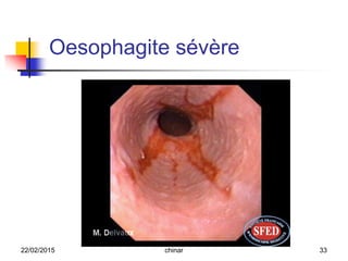Oesophagite sévère
22/02/2015 33chinar
 