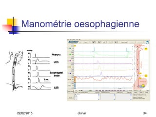 Manométrie oesophagienne
22/02/2015 34chinar
 