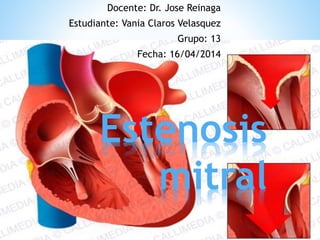 Estenosis
mitral
Docente: Dr. Jose Reinaga
Estudiante: Vania Claros Velasquez
Grupo: 13
Fecha: 16/04/2014
 