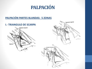 PALPACIÓN
PALPACIÓN PARTES BLANDAS: 5 ZONAS
I.- TRIANGULO DE SCARPA
 