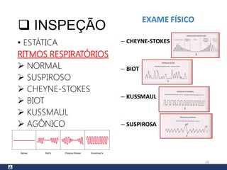  INSPEÇÃO
• ESTÁTICA
RITMOS RESPIRATÓRIOS
 NORMAL
 SUSPIROSO
 CHEYNE-STOKES
 BIOT
 KUSSMAUL
 AGÔNICO
28
 