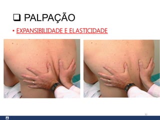  PALPAÇÃO
• EXPANSIBILIDADE E ELASTICIDADE
32
 
