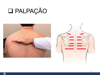  PALPAÇÃO
35
 