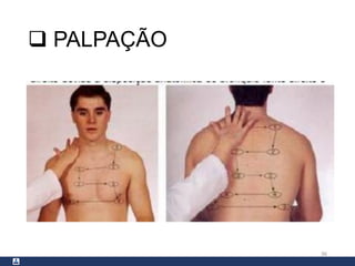  PALPAÇÃO
36
 