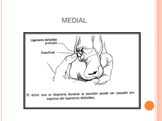 MEDIAL
 