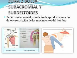  Bursitis subacromial y sundeltoides producen mucho
 dolor y restricción de los movimientos del hombro
 