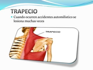  Cuando ocurren accidentes automilistico se
 lesiona muchas veces
 