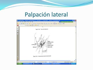 Palpación lateral
 