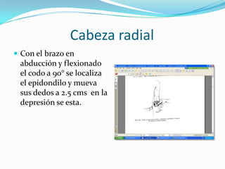 Cabeza radial
 Con el brazo en
 abducción y flexionado
 el codo a 90° se localiza
 el epidondilo y mueva
 sus dedos a 2.5 cms en la
 depresión se esta.
 