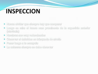 INSPECCION
 
