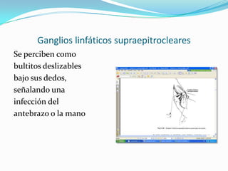 Ganglios linfáticos supraepitrocleares
Se perciben como
bultitos deslizables
bajo sus dedos,
señalando una
infección del
antebrazo o la mano
 