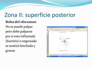 Zona II: superficie posterior
Bolsa del olecranon
No se puede palpar
pero debe palparse
por si esta inflamada
(bursitis) o engrosada
se sentirá hinchada y
gruesa
 