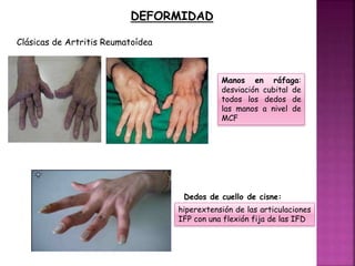 semiolog-a-de-exploraci-n-de-mano-pptx