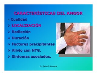 Semiología de la Angina de Pecho
