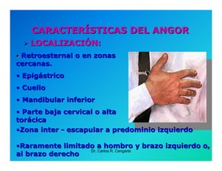 Semiología de la Angina de Pecho
