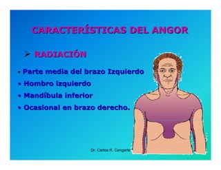 Semiología de la Angina de Pecho