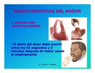 Semiología de la Angina de Pecho