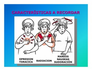 Semiología de la Angina de Pecho