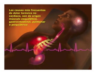 Semiología de la Angina de Pecho